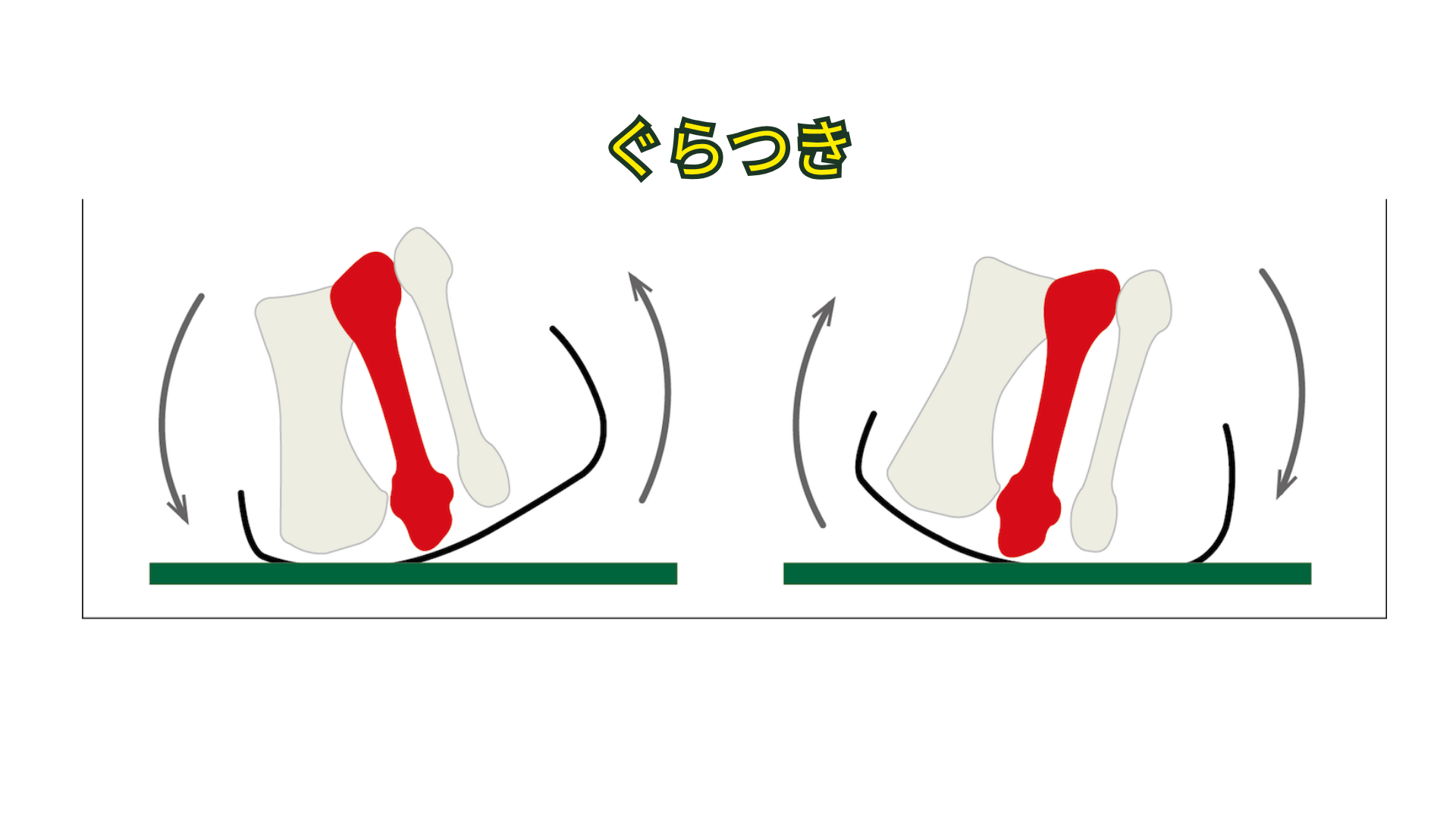 前足部の接地条件によるぐらつきの模式図